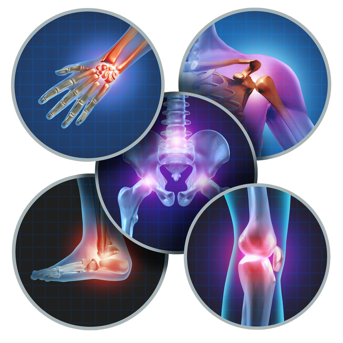 Allicin and Joint Health - A Visual Guide: Close-up of Garlic Cloves, Joint Health Supplements, and a Person Engaging in Low-Impact Exercise with Text Overlay - Exploring the Therapeutic Connection Between Allicin and Joint Health.